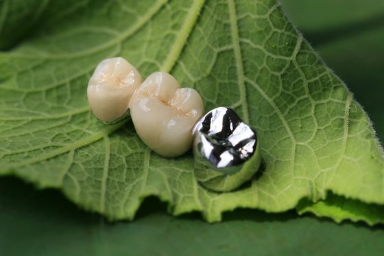 الإطار المعدني PFM Dental Crown
