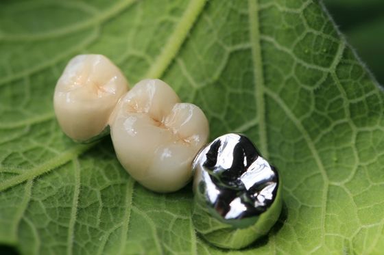الإطار المعدني PFM Dental Crown