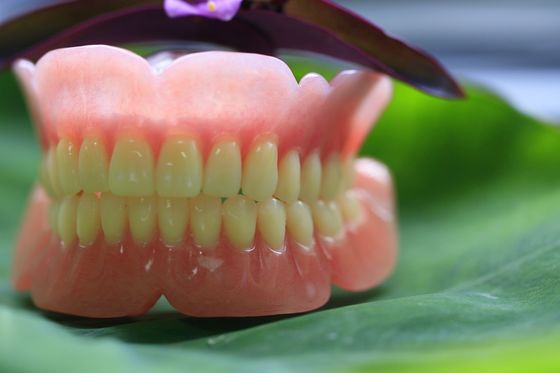 طقم أسنان جزئي أكريليك مقوس بالكامل