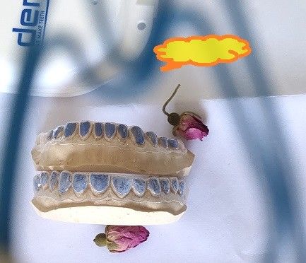 صينية تبييض الأسنان المخصصة ISO13485