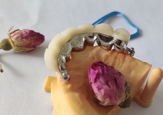 الإطار المعدني PFM Dental Crown