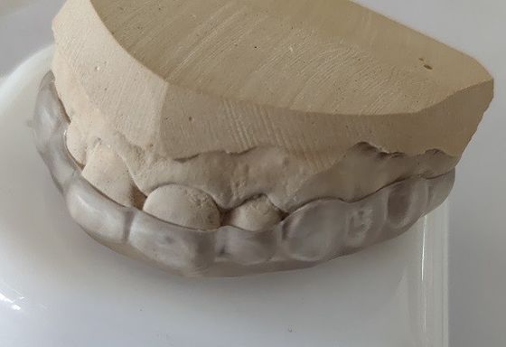 قطعة الفم ذات القوس السفلي لتجميل الأسنان