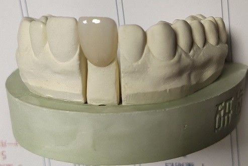 كتل زركونيا لطباعة الأسنان ثلاثية الأبعاد بواسطة CAD CAM Milling