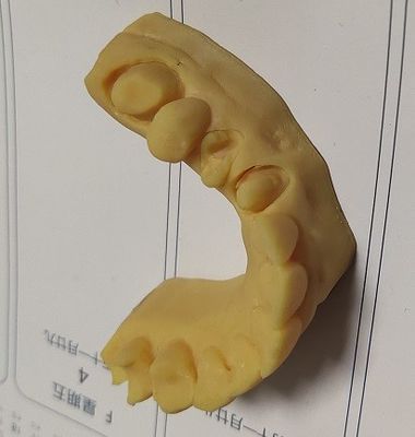 عالية الدقة ISO13485 نموذج Trushine Dental 3D Print
