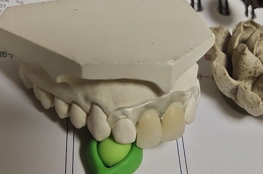 طقم أسنان غير مرئي ناعم ومرن من Valplast