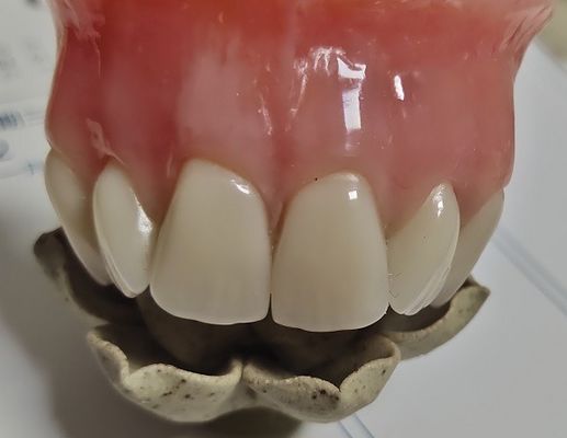 جماليات طقم أسنان كامل من الأكريليك معالج على البارد