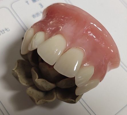 ISO13485 طقم أسنان تقليدي أكريليك علوي جزئي