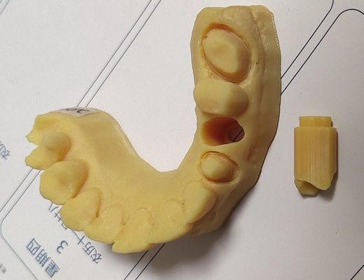 عالية الدقة ISO13485 نموذج Trushine Dental 3D Print