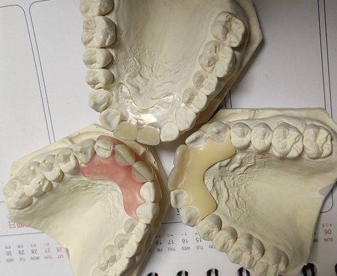 طقم أسنان غير مرئي ناعم ومرن من Valplast