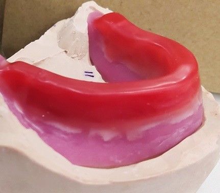 كتل سجلات Trushine لطب الأسنان الكامل النهائي