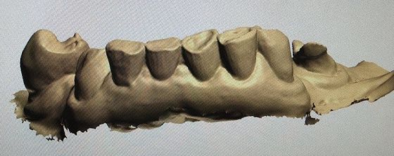 نموذج رقمي ثلاثي الأبعاد للأسنان منتجات طب الأسنان الأخرى