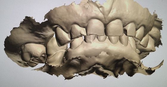 CAD CAM Design Digital Display Mockup Teeth منتجات طب الأسنان الأخرى