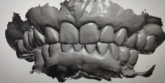 CAD CAM Design Digital Display Mockup Teeth منتجات طب الأسنان الأخرى