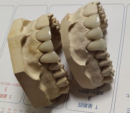 الخزف CAD CAM PFM Crown
