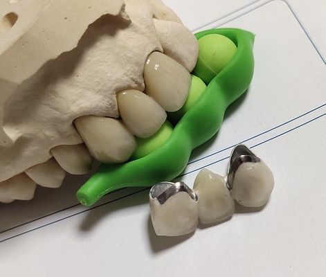 الخزف CAD CAM PFM Crown