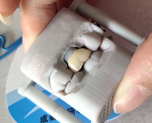 مختبر PFM Dental Crown 3D طباعة Bridge Dental Crown