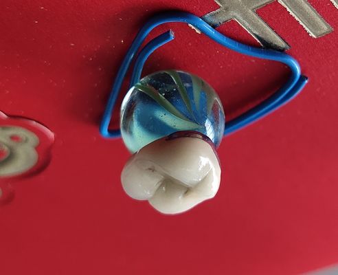 الأسنان مختبر المنتج CAD CAM PFM Crown الخزف المنصهر في المعدن