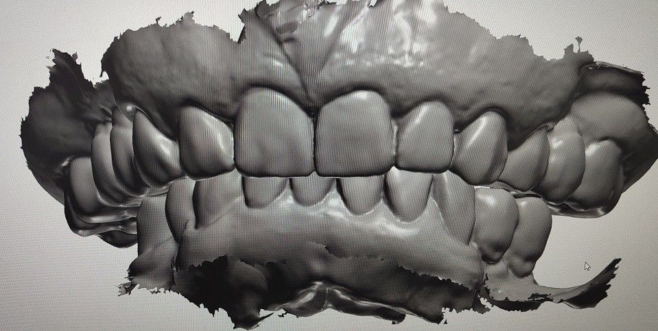 CAD CAM Design Digital Display Mockup Teeth منتجات طب الأسنان الأخرى
