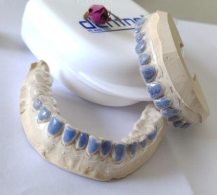 دليل مبيض مسبق الصنع من رقائق معدنية للمدخنين